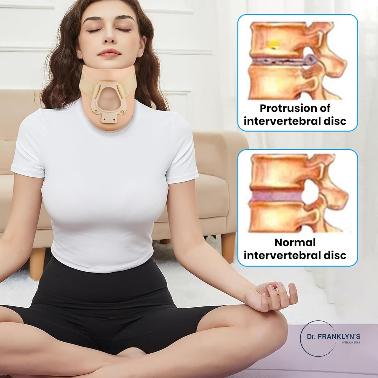 Cervical neck brace with tracheostomy opening for neck stabilization and spinal support. 5